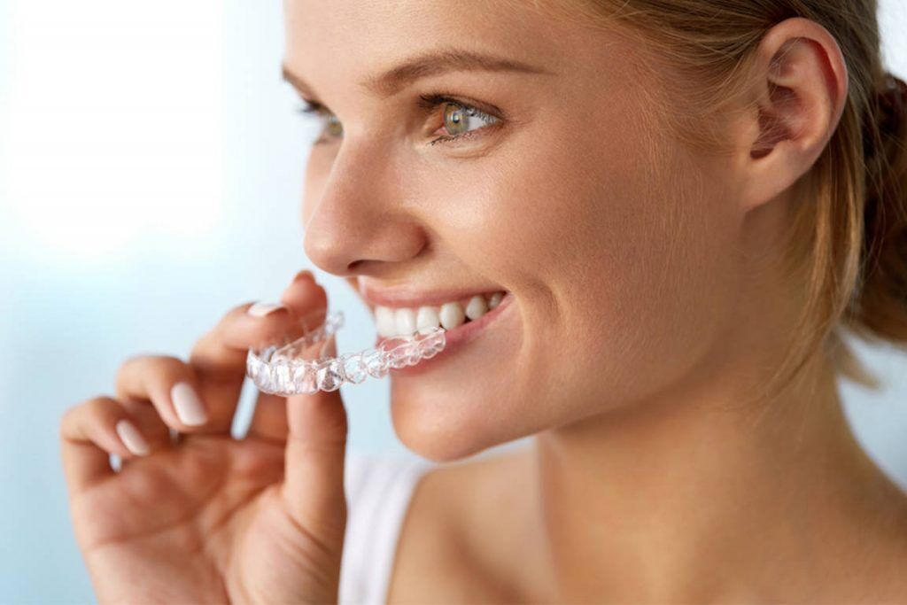 The Cost Of Invisalign Compared To Other Braces Options